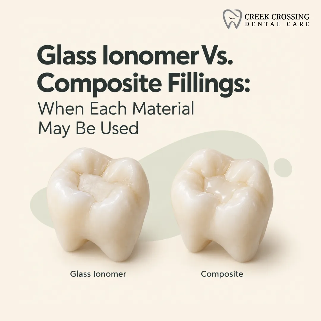 Glass Ionomer Vs. Composite Fillings: When Each Material May Be Used