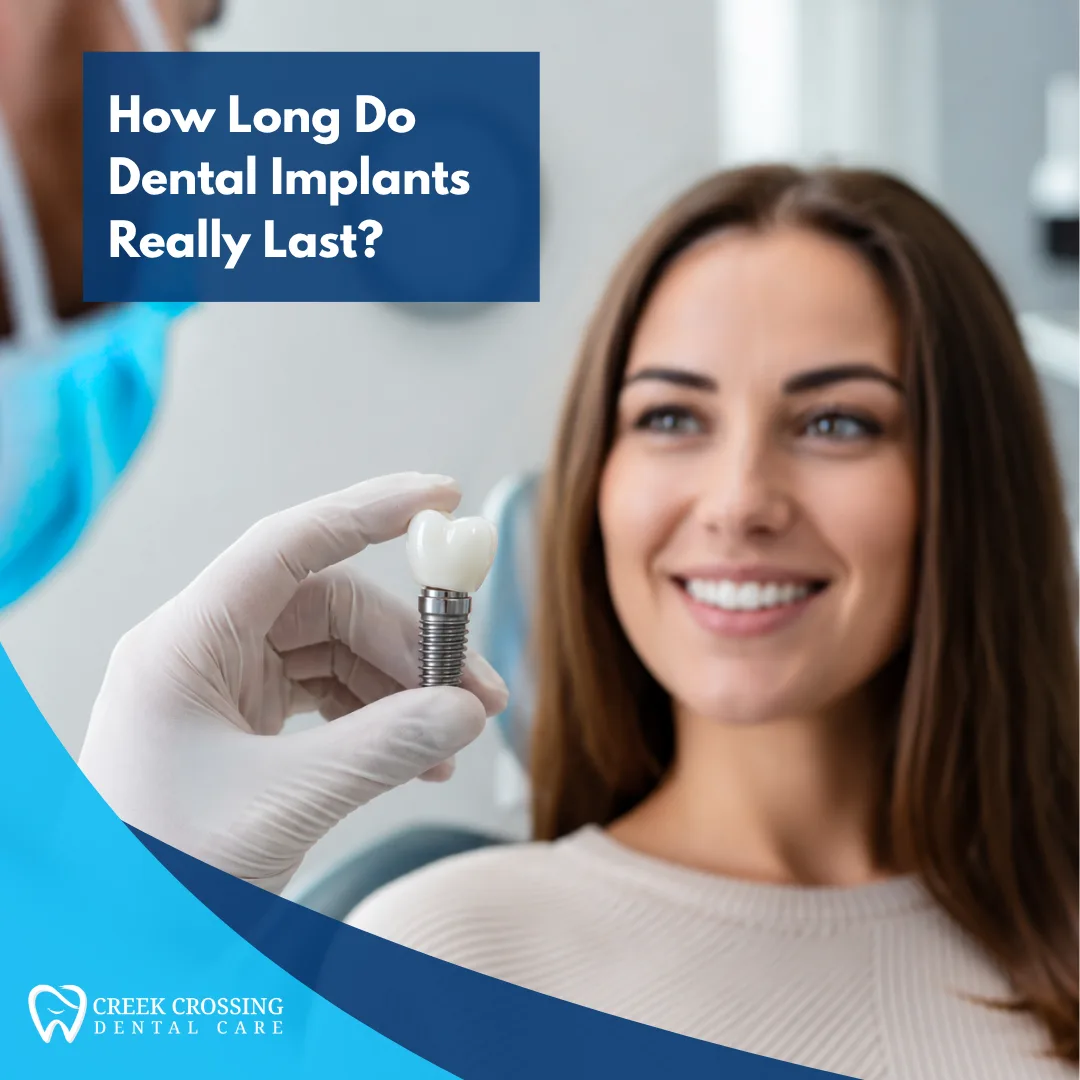 How Long Do Dental Implants Really Last?
