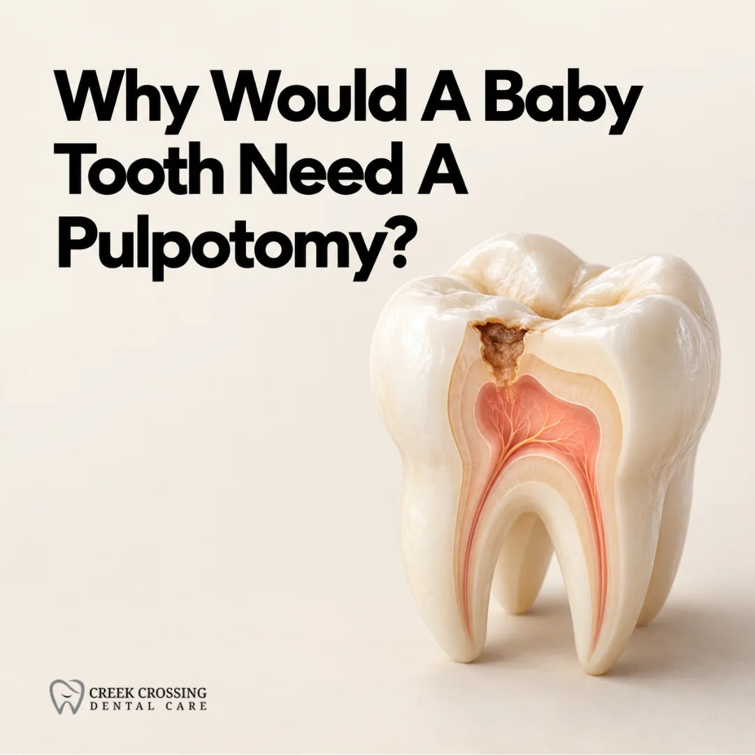 Why Would A Baby Tooth Need A Pulpotomy?