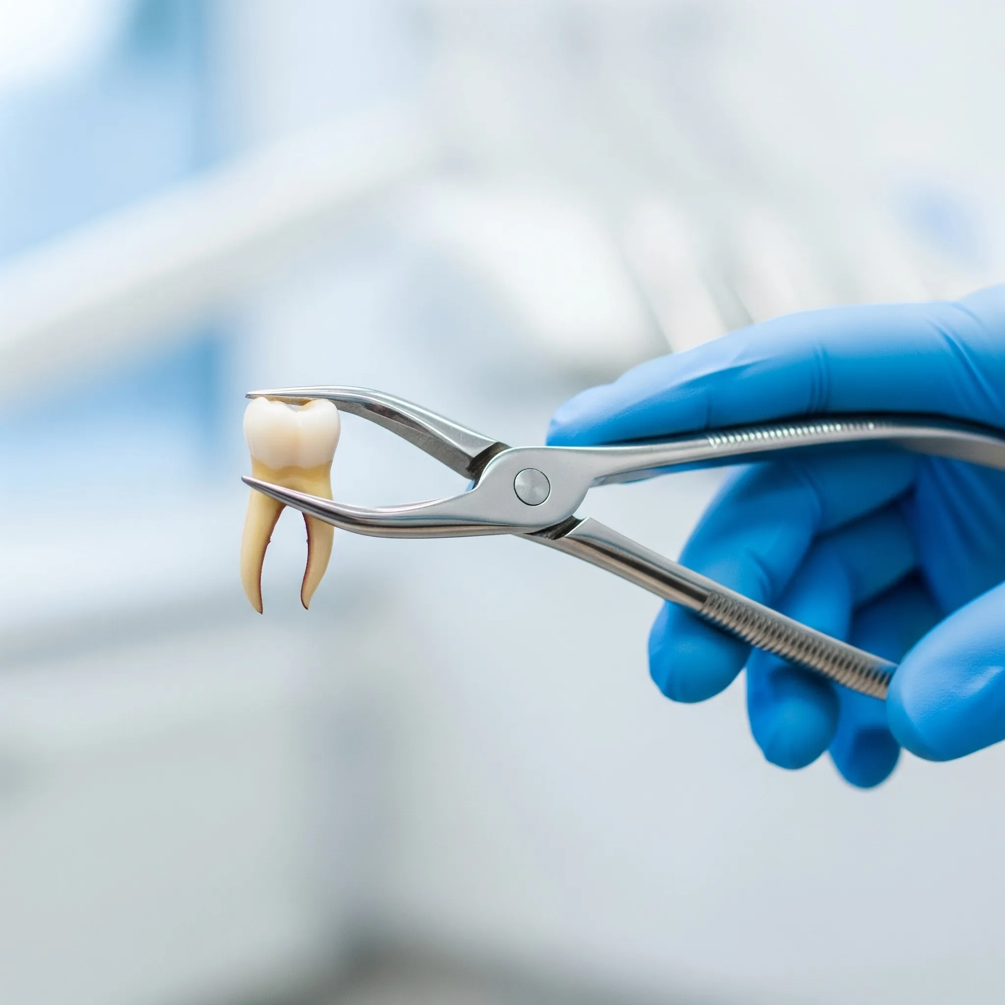 Simple versus surgical tooth extraction options in Mesquite, TX